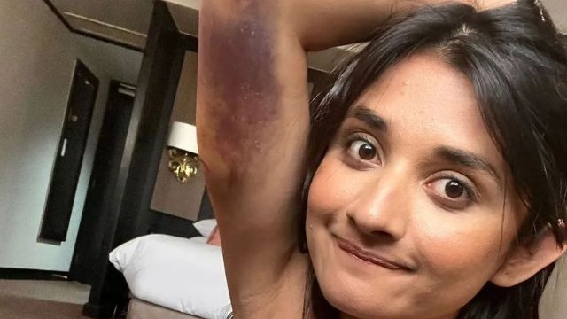 Khatron Ke Khiladi 12: Actress Kanika Mann injured during a task